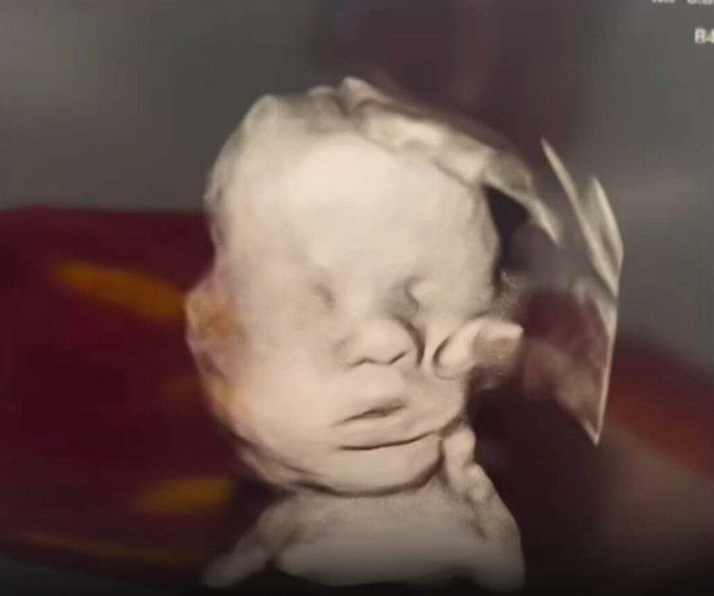 God’s Hand Appears in Woman’s Ultrasound