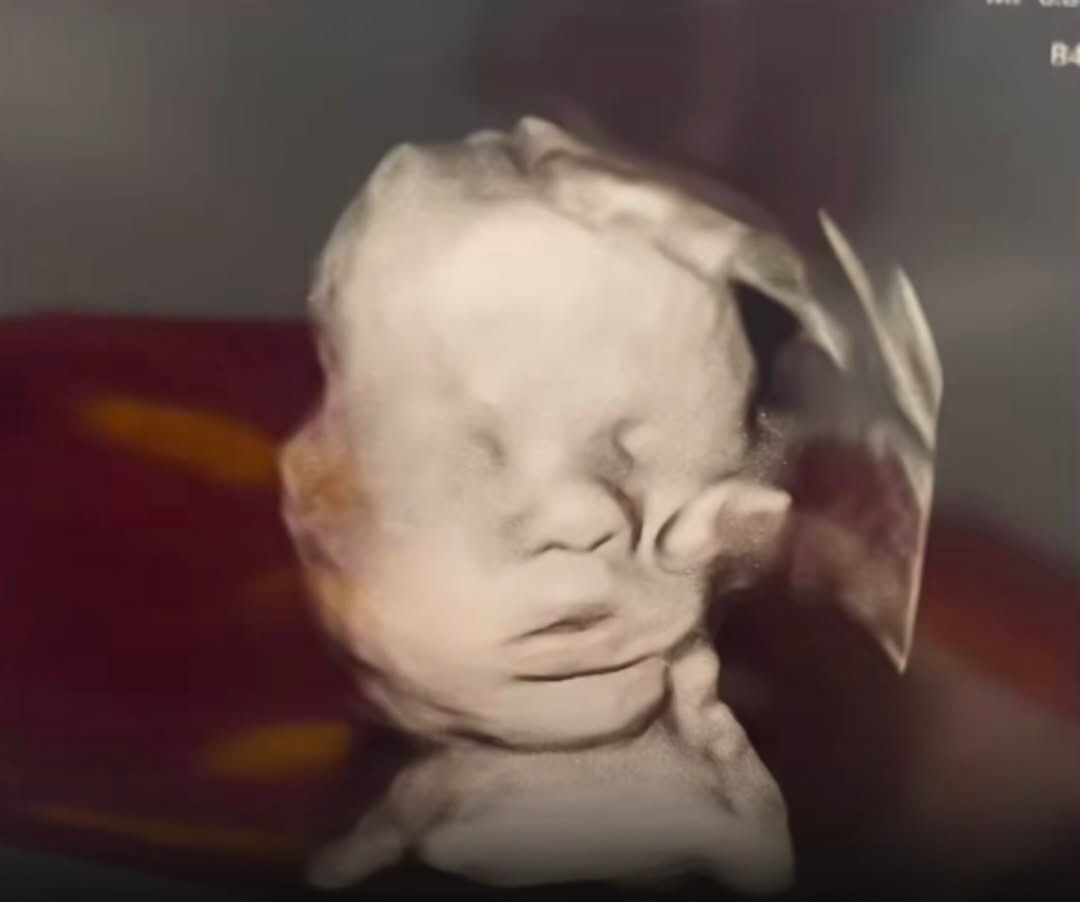 God’s Hand Appears in Woman’s Ultrasound